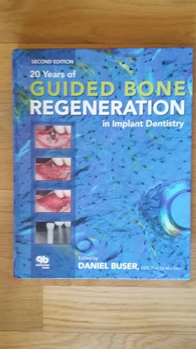 Image of - 20 Years of Guided Bone Regeneration in Implant Dentistry | 2nd Edition | Hardcover