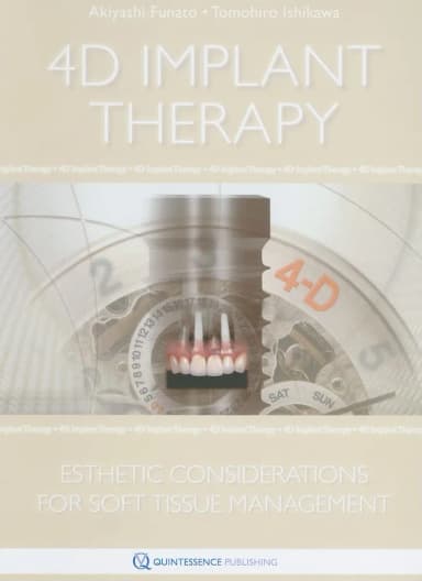 Image of - 4D Implant Therapy Esthetic Considerations for Soft Tissue Management | Hardcover