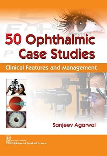 Image of - 50 Ophthalmic Case Studies Clinical Features and Management | Paperback