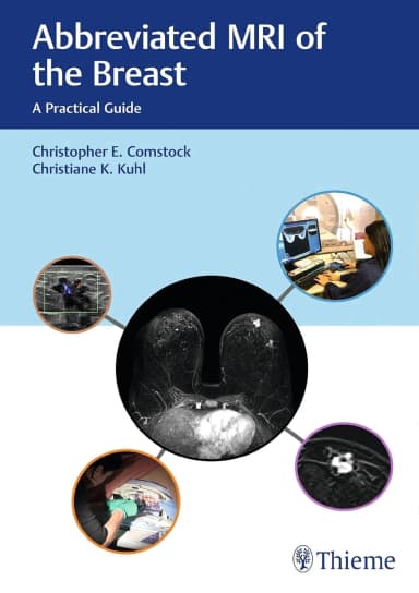Image of - Abbreviated MRI of the Breast | Hardcover