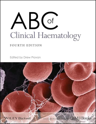 Image of - Abc Of Clinical Hematology 4th Edition | Paperback