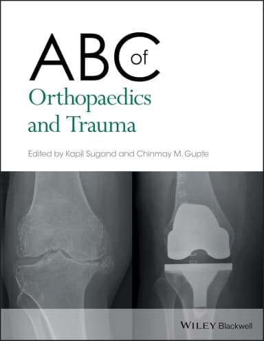 Image of - Abc Of Orthopaedics And Trauma | Paperback