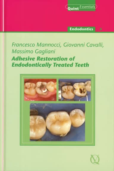 Image of - Adhesive Restoration of Endodontically Treated Teeth | Hardcover