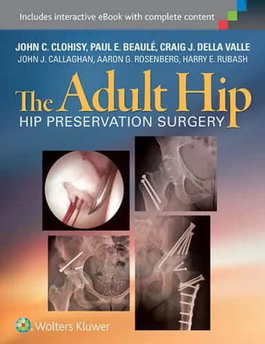 Image of - The Adult Hip Hip Preservation Surgery | Hardcover