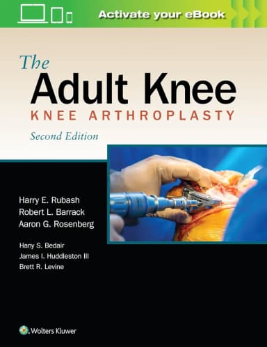 Image of - The Adult Knee 2nd Edition | Hardcover