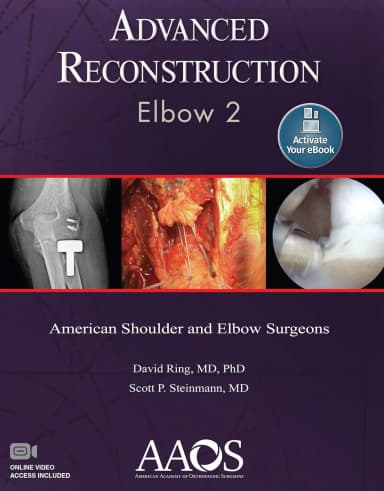 Image of - Advanced Reconstruction Elbow 2 | Paperback
