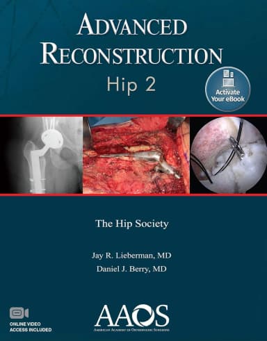 Image of - Advanced Reconstruction Hip 2 | Paperback