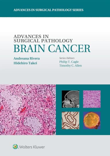Image of - Advances in Surgical Pathology Brain Cancer | Paperback