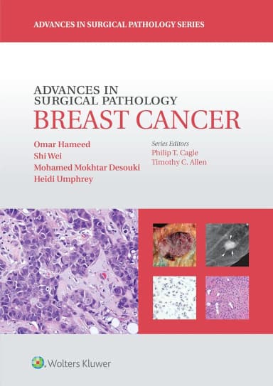 Image of - Advances in Surgical Pathology Breast Cancer | Hardcover