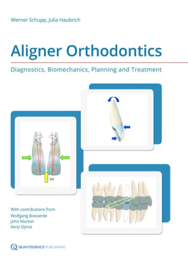 Image of - Aligner Orthodontics Diagnostics | Biomechanics | Planning and Treatment | Hardcover