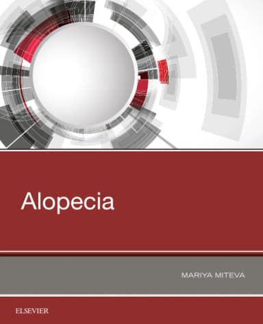 Image of - Alopecia | Paperback