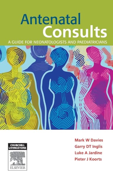 Image of - Antenatal Consults | Paperback