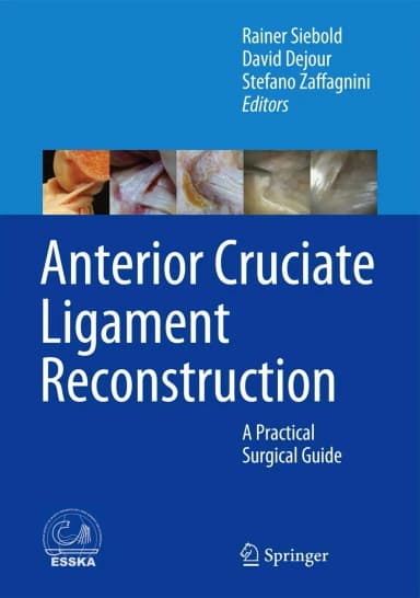 Image of - Anterir Cruciate Ligament Reconstruction | Hardcover