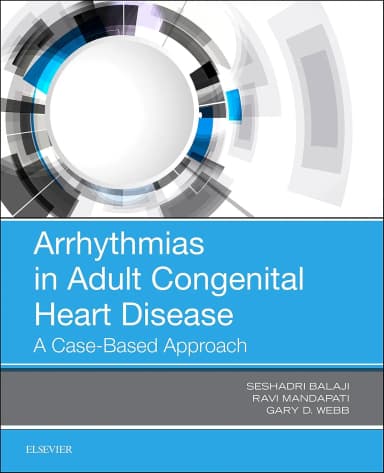 Image of - Arrhythmias In Adult Congenital Heart Disease | Paperback