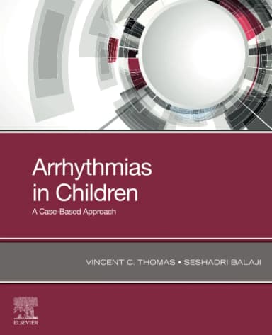 Image of - Arrhythmias In Children A Case Based Approach | Paperback