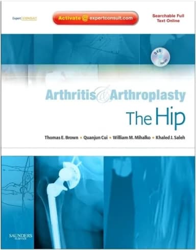 Image of - Arthritis and Arthoplasty The Hip With DVD | Hardcover