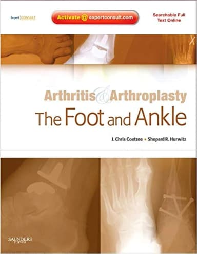 Image of - Arthritis and Arthroplasty The Foot and Ankle | With DVD | Hardcover