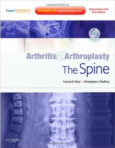 Image of - Arthritis and Arthroplasty The Spine | With DVD | Hardcover