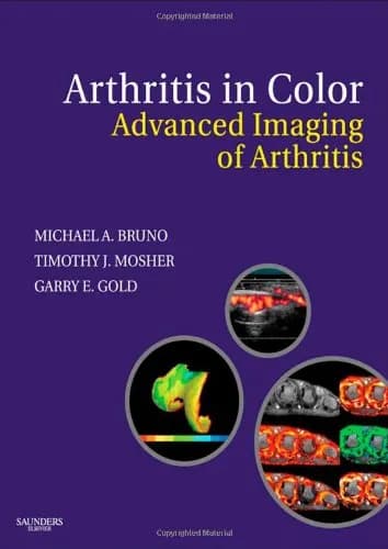 Image of - Arthritis in Color Advanced Imaging of Arthritis | Hardcover