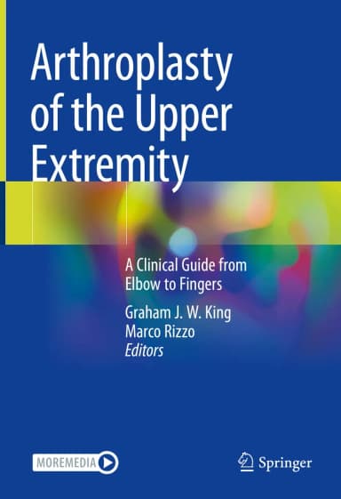 Image of - Arthroplasty Of The Upper Extremity A Clinical Guide From Elbow To Fingers | Hardcover