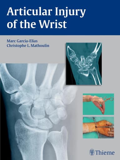 Image of - Articular Injury of the Wrist | Hardcover