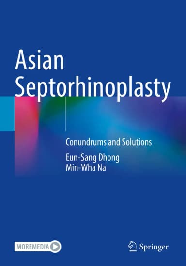 Image of - Asian Septorhinoplasty Conundrums And Solutions | Paperback