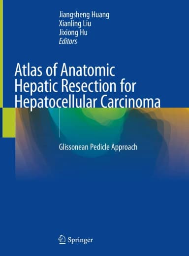 Image of - Atlas of Anatomic Hepatic Resection for Hepatocellular Carcinoma | Hardcover