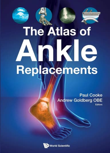 Image of - The Atlas Of Ankle Replacements | Paperback