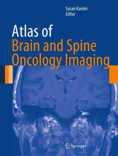 Image of - Atlas of Brain and Spine Oncology Imaging | Hardcover