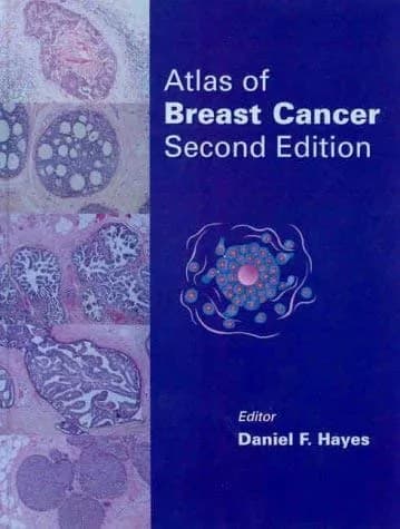 Image of - Atlas of Breast Cancer