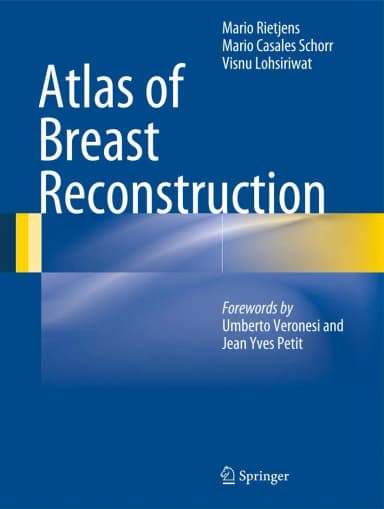 Image of - Atlas of Breast Reconstruction | Hardcover