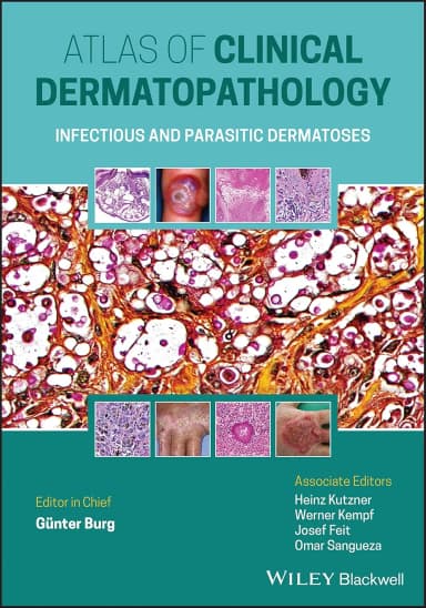 Image of - Atlas Of Clinical Dermatopathology Infectious And Parasitic Dermatoses | Hardcover