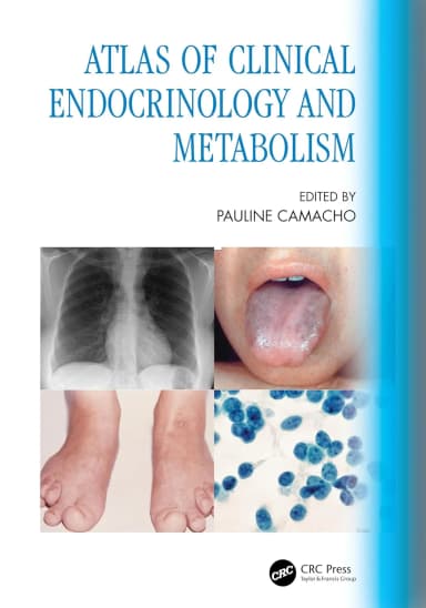Image of - Atlas Of Clinical Endocrinology And Metabolism | Paperback