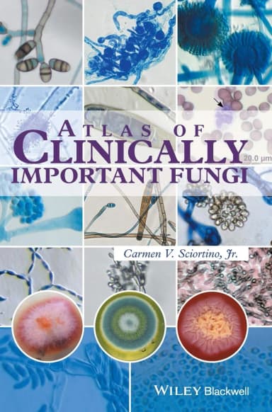 Image of - Atlas of Clinically Important Fungi | Hardcover