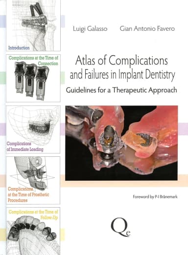 Image of - Atlas of Complications and Failures in Implant Dentistry | Hardcover