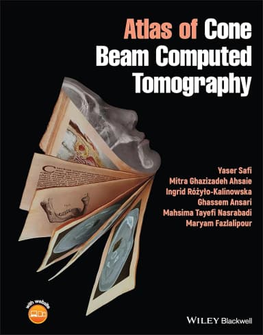 Image of - Atlas Of Cone Beam Computed Tomography | Hardcover