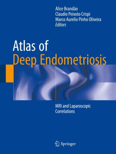 Image of - Atlas of Deep Endometriosis | Hardcover