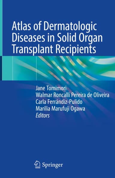 Image of - Atlas Of Dermatologic Diseases In Solid Organ Transplant Recipients | Hardcover
