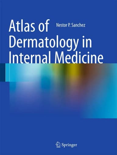 Image of - Atlas of Dermatology in Internal Medicine | Paperback
