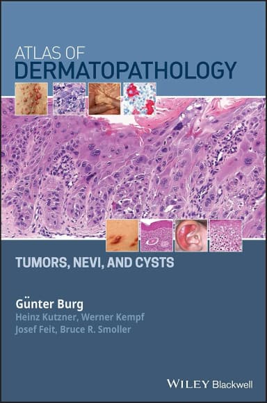 Image of - Atlas of Dermatopathology Tumors | Nevi | and Cysts | Hardcover