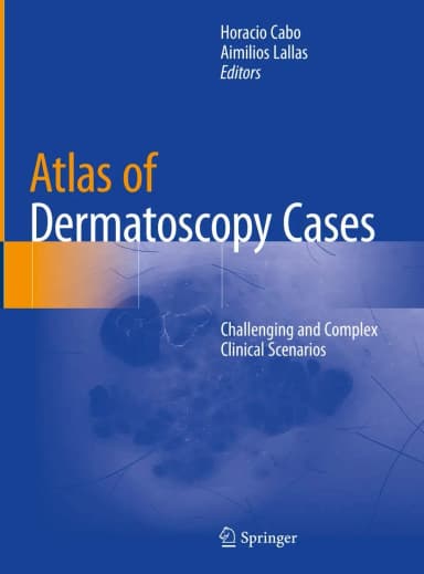 Image of - Atlas Of Dermatoscopy Cases Challenging And Complex Clinical Scenarios | Hardcover