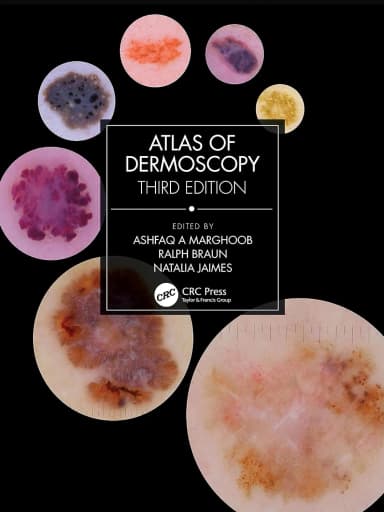 Image of - Atlas Of Dermoscopy Third Edition | Hardcover