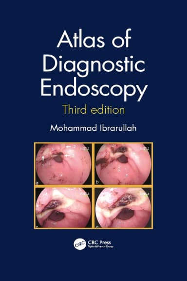 Image of - Atlas Of Diagnostic Endoscopy Third Edition | Paperback