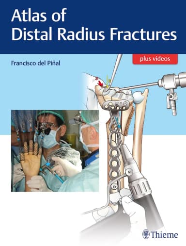 Image of - Atlas of Distal Radius Fractures | Hardcover