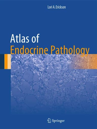 Image of - Atlas of Endocrine Pathology | Hardcover