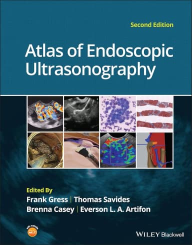Image of - Atlas Of Endoscopic Ultrasonography 2nd Edition | Hardcover