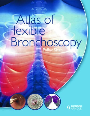 Image of - Atlas Of Flexible Bronchoscopy | Hardcover