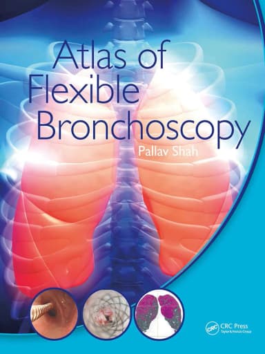 Image of - Atlas Of Flexible Bronchoscopy | Paperback