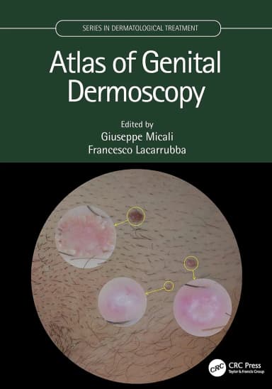 Image of - Atlas Of Genital Dermoscopy | Hardcover