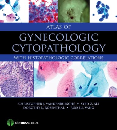 Image of - Atlas of Gynecologic Cytopathology | Hardcover